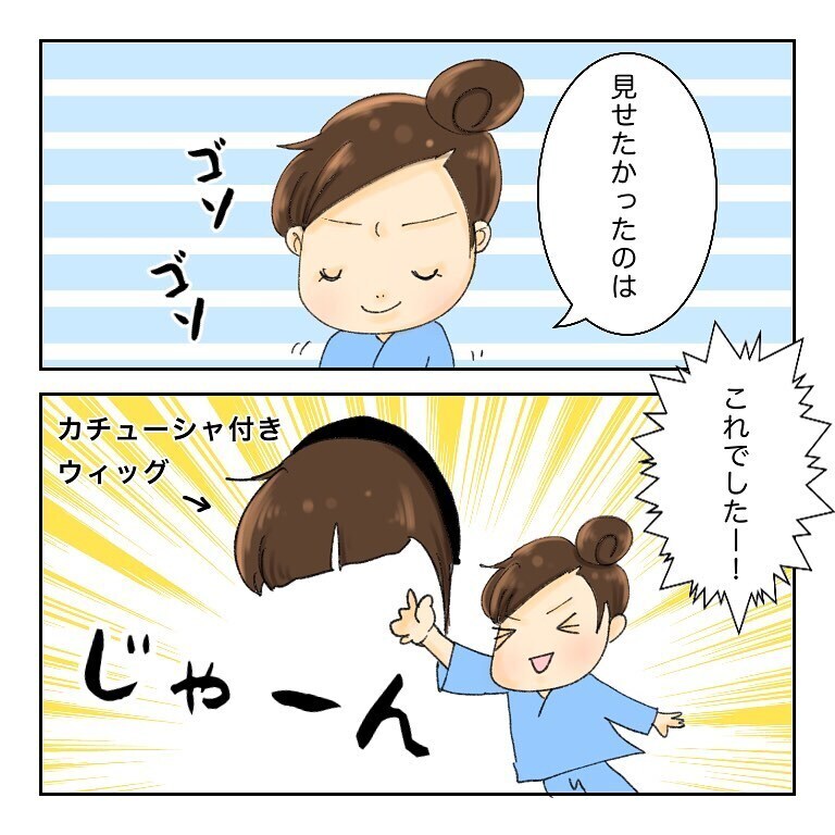 抜け毛が多い抗がん剤治療　ウィッグの話で盛り上がっていると…【鼻腔ガンになった話 Vol.32】