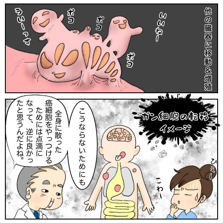 2回目の抗がん剤投与は点滴に決定！ しかし、準備の段階で顔がパンパンに…【鼻腔ガンになった話 Vol.36】