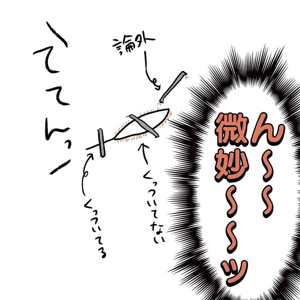 通院後、傷の状態はいかに？　再処置を迷う母の最後の切り札【初めての子どもの大けが Vol.9】