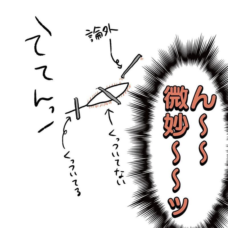 通院後、傷の状態はいかに？　再処置を迷う母の最後の切り札【初めての子どもの大けが Vol.9】