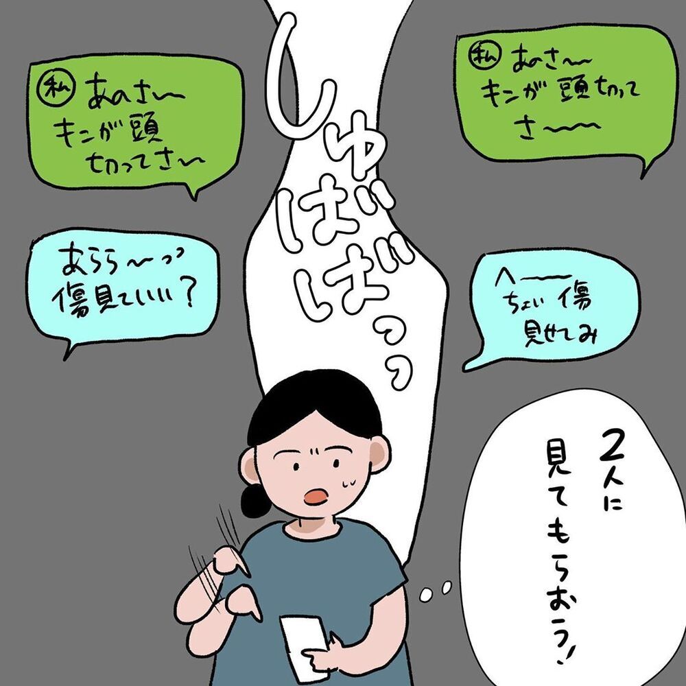 通院後、傷の状態はいかに？　再処置を迷う母の最後の切り札【初めての子どもの大けが Vol.9】