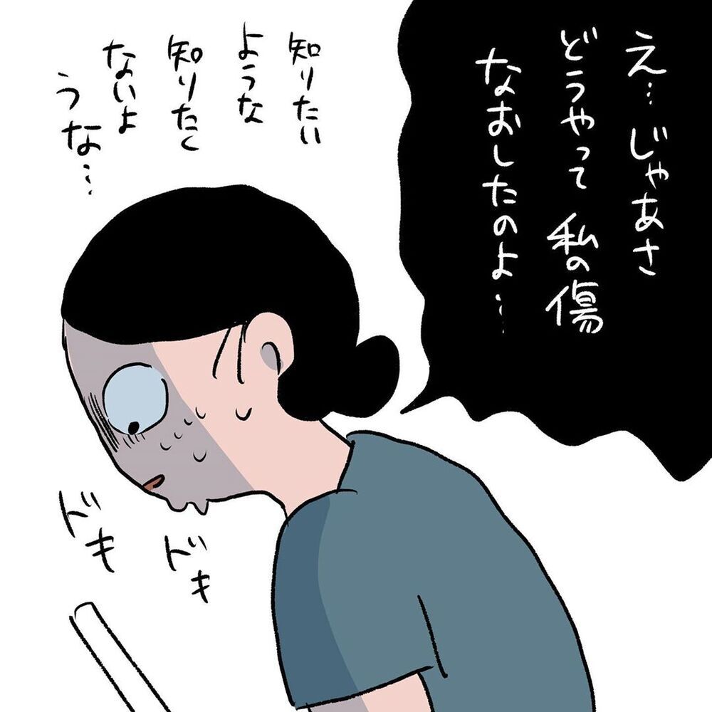 私も息子と同じようなケガをしていた…！母が明かした驚きの過去【初めての子どもの大けが Vol.10】