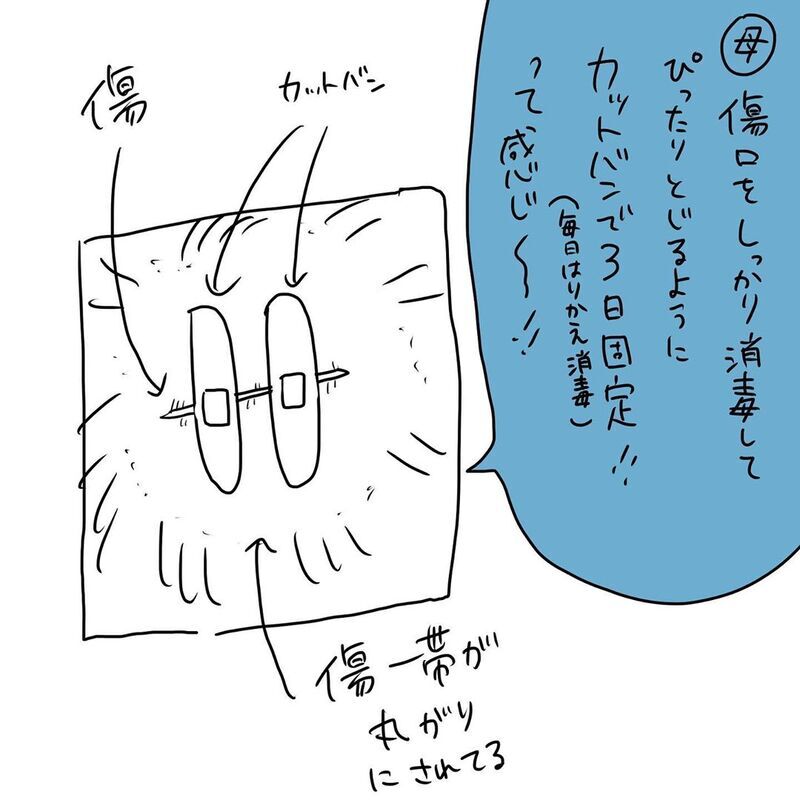 まさかアレで傷口を!?  当時の処置方法に思わず吹き出した！【初めての子どもの大けが Vol.11】