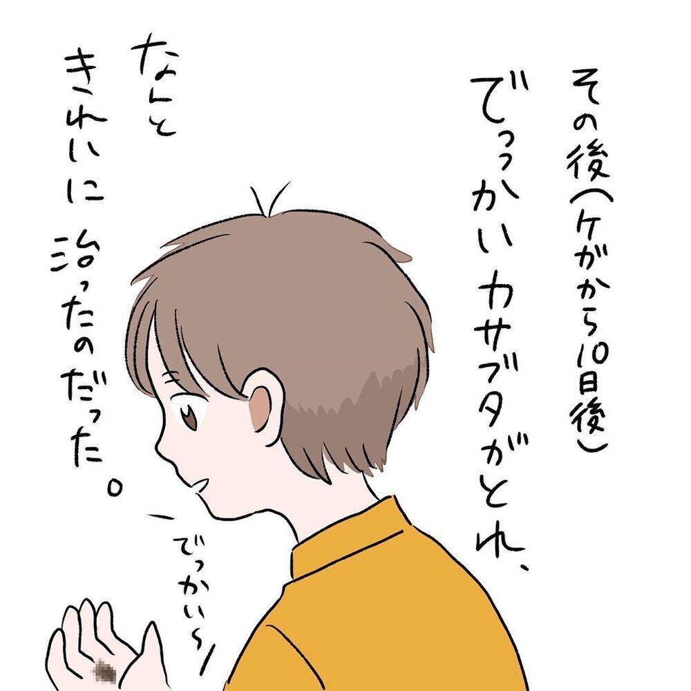 子どもにケガさせてしまったという罪悪感　でも本当に大切なのは…【初めての子どもの大けが Vol.14】