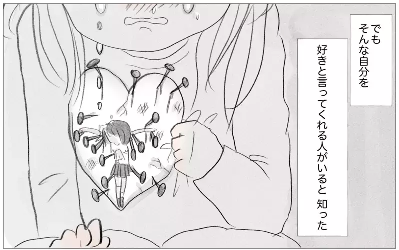 整形を知った彼の反応は…!? 母の理想の娘でなくても他人から愛される？【親に整形させられた私が、母になる Vol.46】