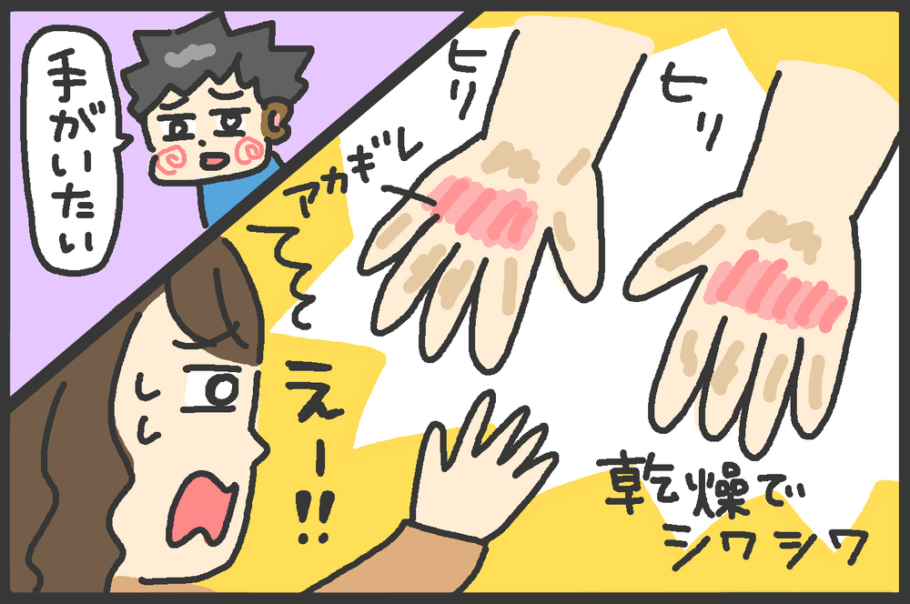 消毒と手洗いで荒れてしまった子どもの手。わが家で人気の保湿アイテムはコレ！【メンズかーちゃん～うちのやんちゃで愛おしいおさるさんの物語～ 第94回】