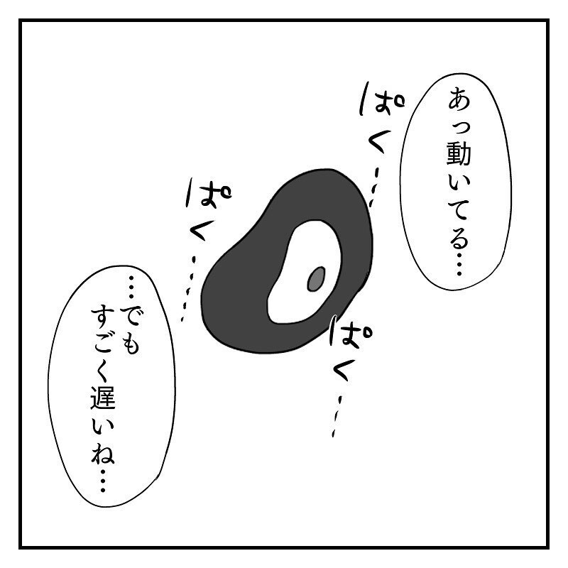 「心臓動いて…ない…？」 心拍を確認し安心していたのに、非情な現実が　【なっちゃんのこと Vol.5】
