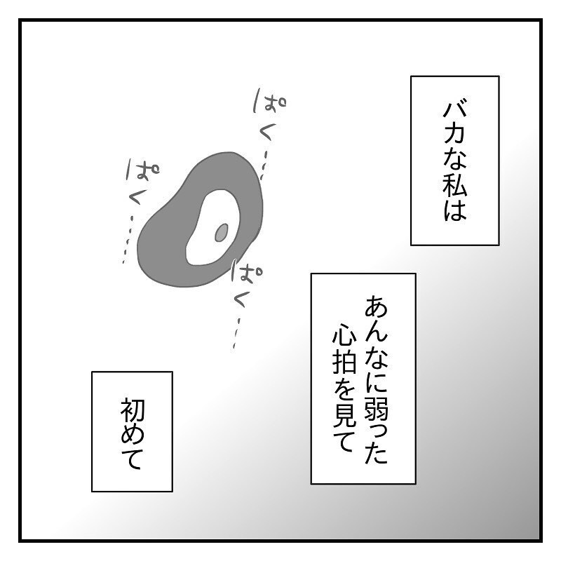 弱々しい心拍を目の当たりにし、ようやく「お腹の子は生きている」ということを実感…【なっちゃんのこと Vol.6】