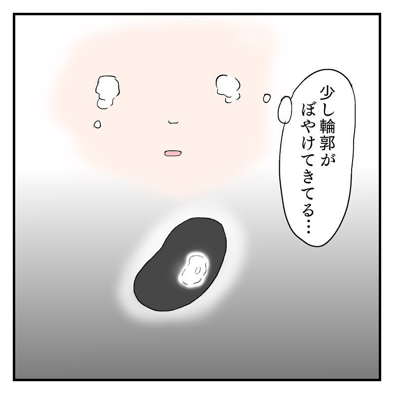 安静にして朝一で病院へ　なっちゃんを診察してもらうと…【なっちゃんのこと Vol.9】