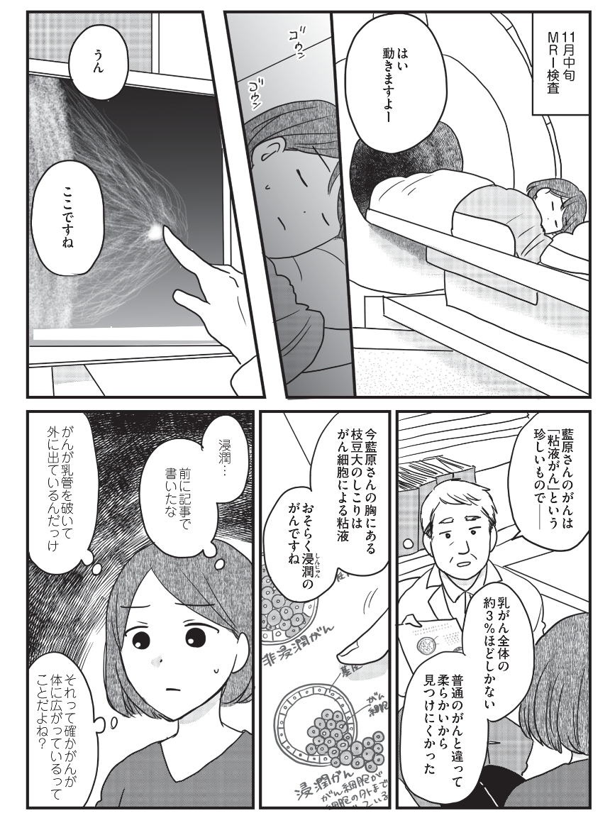 全摘出か温存か…がんの治療法を決めるのは私？　毎晩ネットを検索し焦る日々【がんの記事を書いてきた私が乳がんに!? Vol.2】