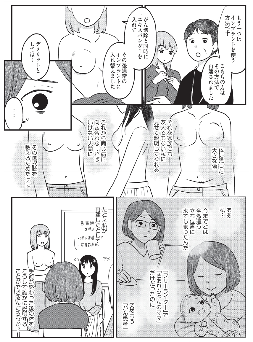 乳がん再建のための会に参加、私はもう「がん患者」なんだ…【がんの記事を書いてきた私が乳がんに!? Vol.3】