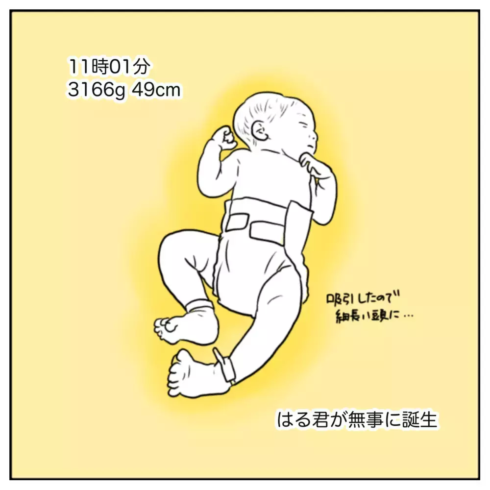 吸引分娩でようやく出産！ 感動の嵐かと思いきや実際は…【出産のキロク Vol.10】