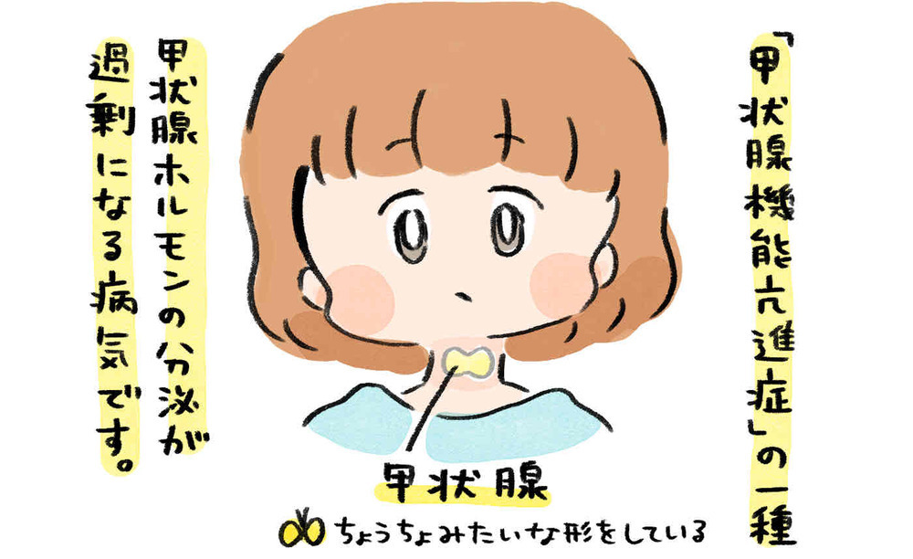 やる気に満ち溢れていた産前が嘘のよう…理想と現実は違いすぎた【産後バセドウ病になった話 Vol.1】