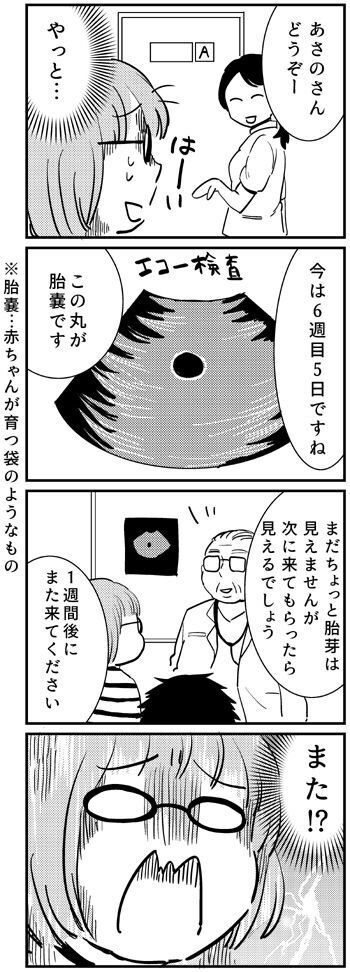 妊娠発覚後、初めて病院へ！ 胎嚢は確認できたけれど…【出産の記録〜低酸素性虚血性脳症の娘と私 Vol.4】