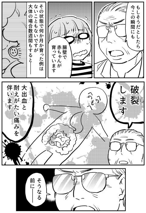 先生の恐ろしい話はさらに続き…あまりの恐怖に失神寸前！【出産の記録〜低酸素性虚血性脳症の娘と私 Vol.8】