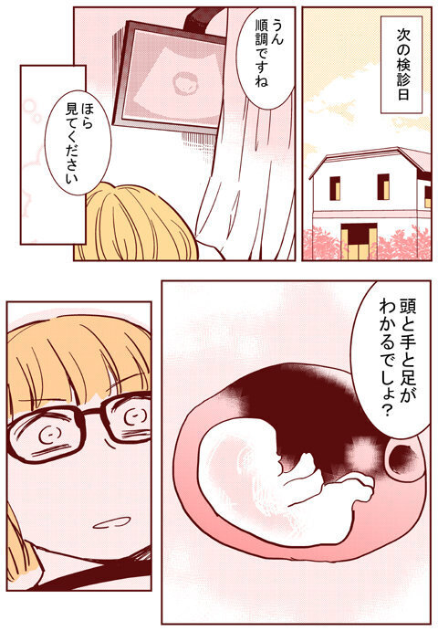 エコーに映る我が子に感動…！ ついに私は妊娠を実感した【出産の記録〜低酸素性虚血性脳症の娘と私 Vol.17】