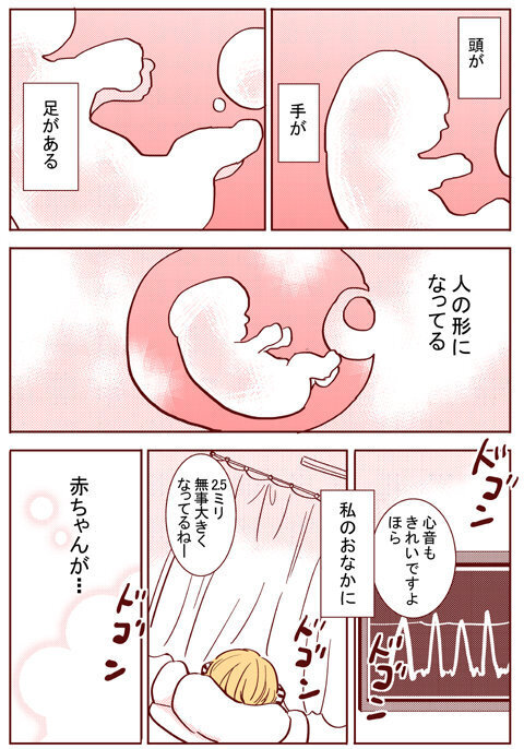 エコーに映る我が子に感動…！ ついに私は妊娠を実感した【出産の記録〜低酸素性虚血性脳症の娘と私 Vol.17】