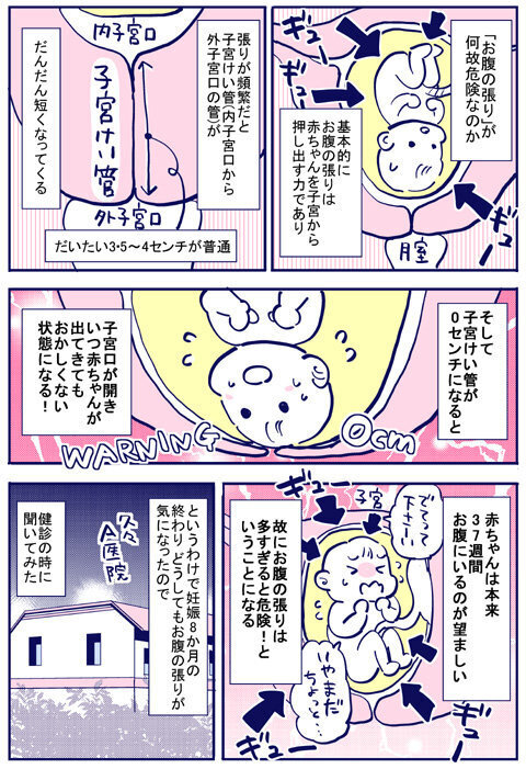 お腹の張りが気になる… 検診で先生に相談してみるとまさかの状況に！【出産の記録〜低酸素性虚血性脳症の娘と私 Vol.24】