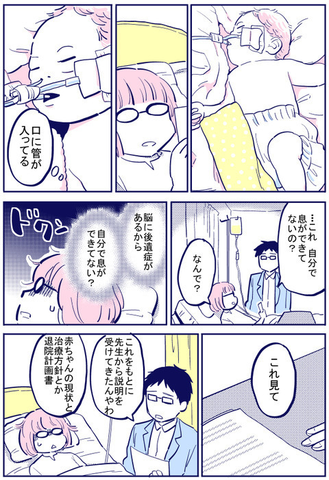 NICUで説明を聞いてきた夫　赤ちゃんに下された診断名は…【出産の記録〜低酸素性虚血性脳症の娘と私 Vol.34】