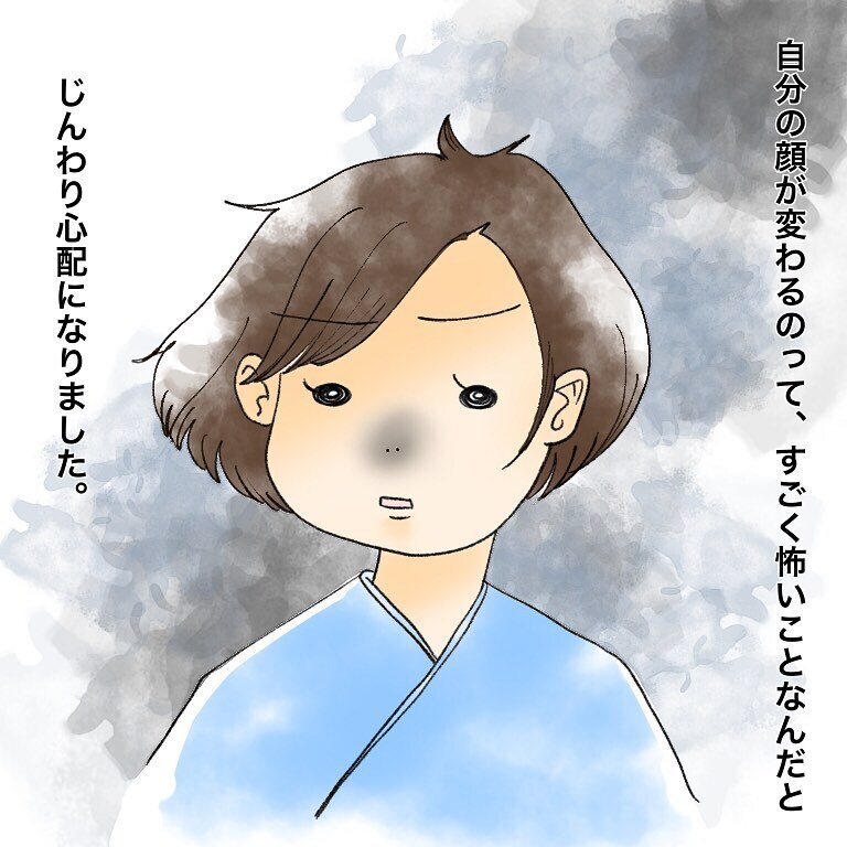 痛い！ 痛すぎる！ 麻酔が切れ、切除した部分が痛んで眠れない！【鼻腔ガンになった話 Vol.56】