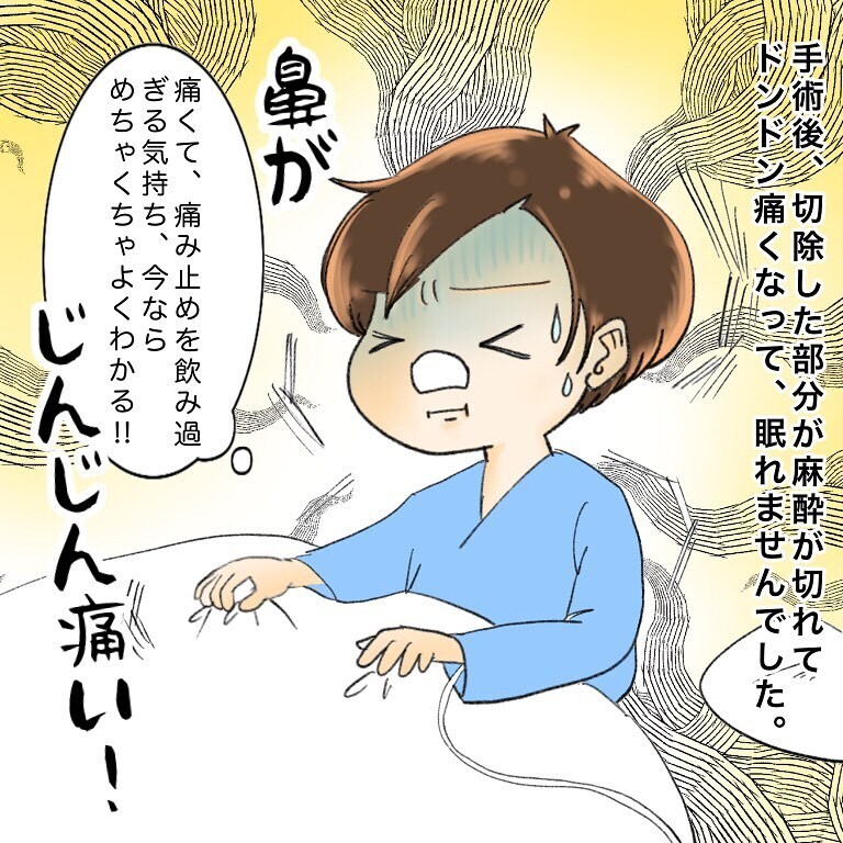 痛い！ 痛すぎる！ 麻酔が切れ、切除した部分が痛んで眠れない！【鼻腔ガンになった話 Vol.56】