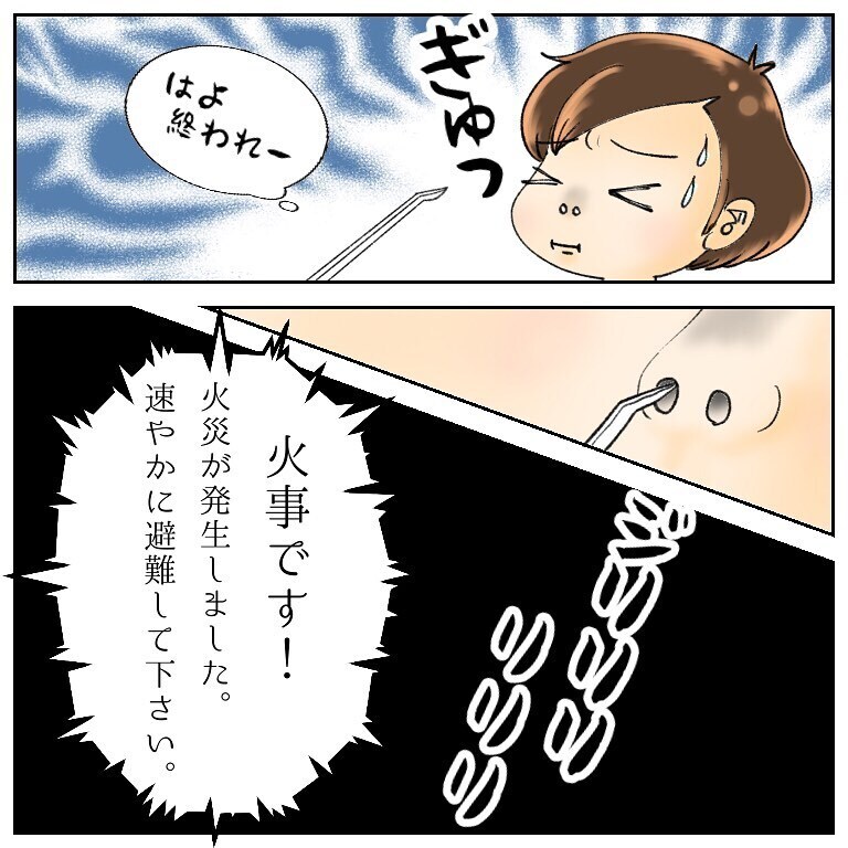 包帯を取ったら退院! 安堵する私を襲ったのはまさかの…!【鼻腔ガンになった話 Vol.61】