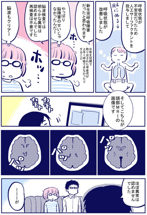 ついにMRIの結果が…！ 主治医からの説明に緊張が走る【出産の記録〜低酸素性虚血性脳症の娘と私 Vol.52】