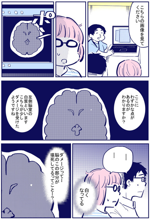 ついにMRIの結果が…！ 主治医からの説明に緊張が走る【出産の記録〜低酸素性虚血性脳症の娘と私 Vol.52】