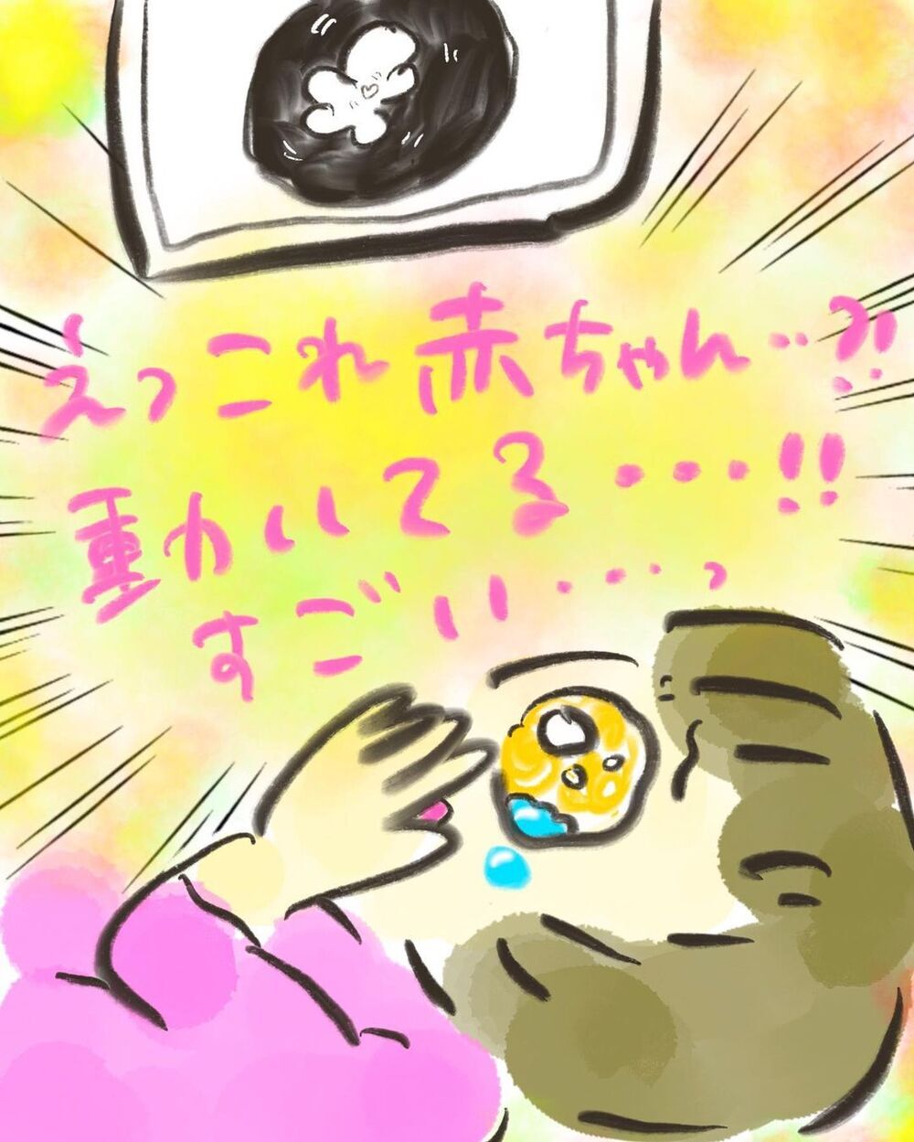 お腹の赤ちゃんに感動！ しかし、ガン検査に引っ掛かってしまい…【妊娠中に前ガン病変が見つかった話  Vol.1】