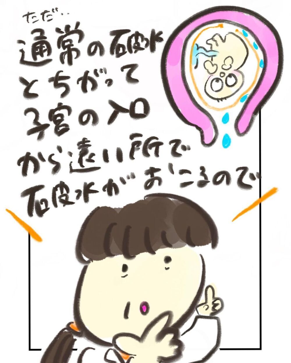 高位破水とは？ しばらくすると痛みが襲ってきた…！【妊娠中に前ガン病変が見つかった話  Vol.13】