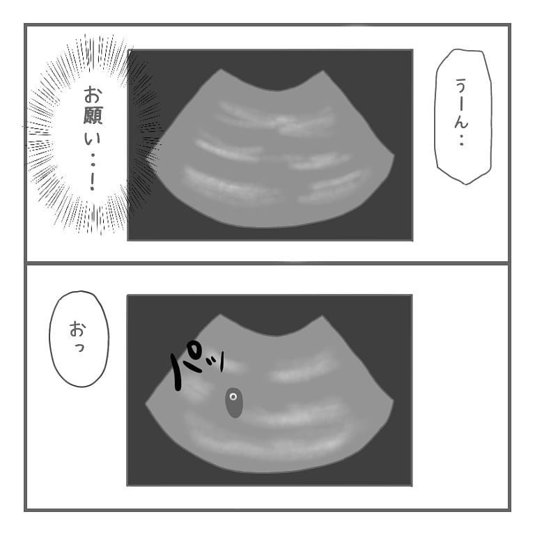 夫の前で明るく振舞うも子宮外妊娠の可能性に不安…、運命の内診の結果は【大事な我が子を産むまで Vol.6】