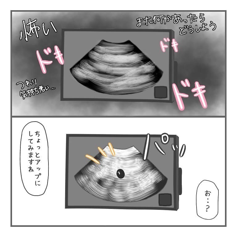 心拍確認、そして出産へ　2年間の妊活を終えて今思うこと【大事な我が子を産むまで Vol.20】