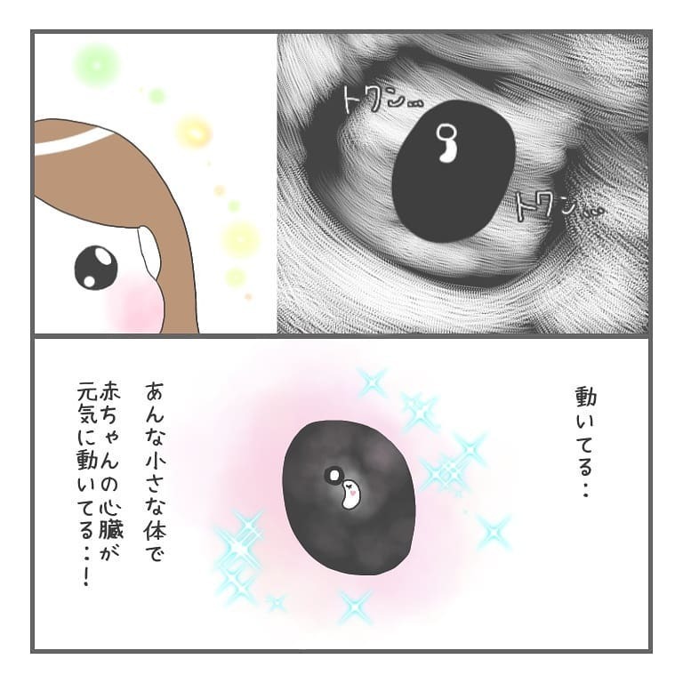 心拍確認、そして出産へ　2年間の妊活を終えて今思うこと【大事な我が子を産むまで Vol.20】