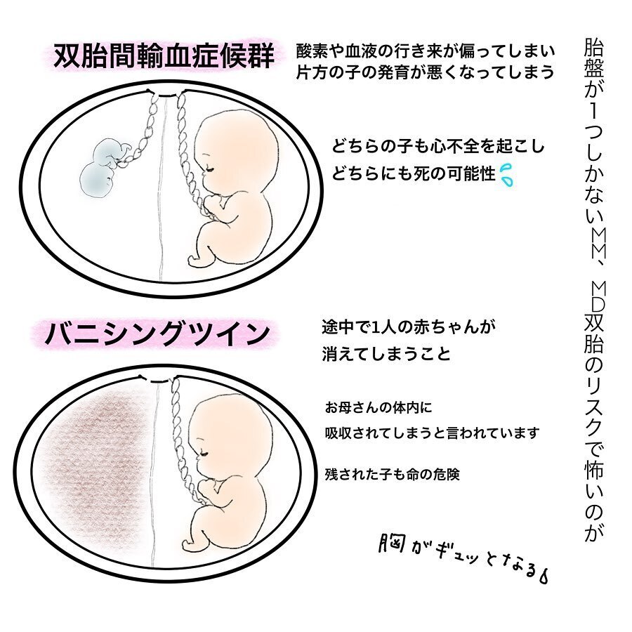 突然の双子妊娠に動揺!? 多胎妊娠のリスクを知り不安に…【双子妊娠出産レポ Vol.1】