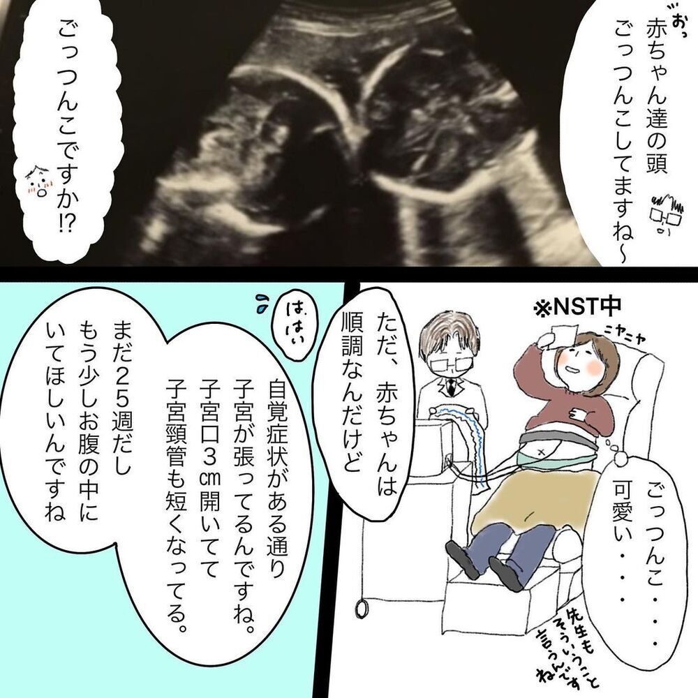 切迫早産で入院！ 様々なマイナートラブルに見舞われるもなんとか36週へ…【双子妊娠出産レポ Vol.2】