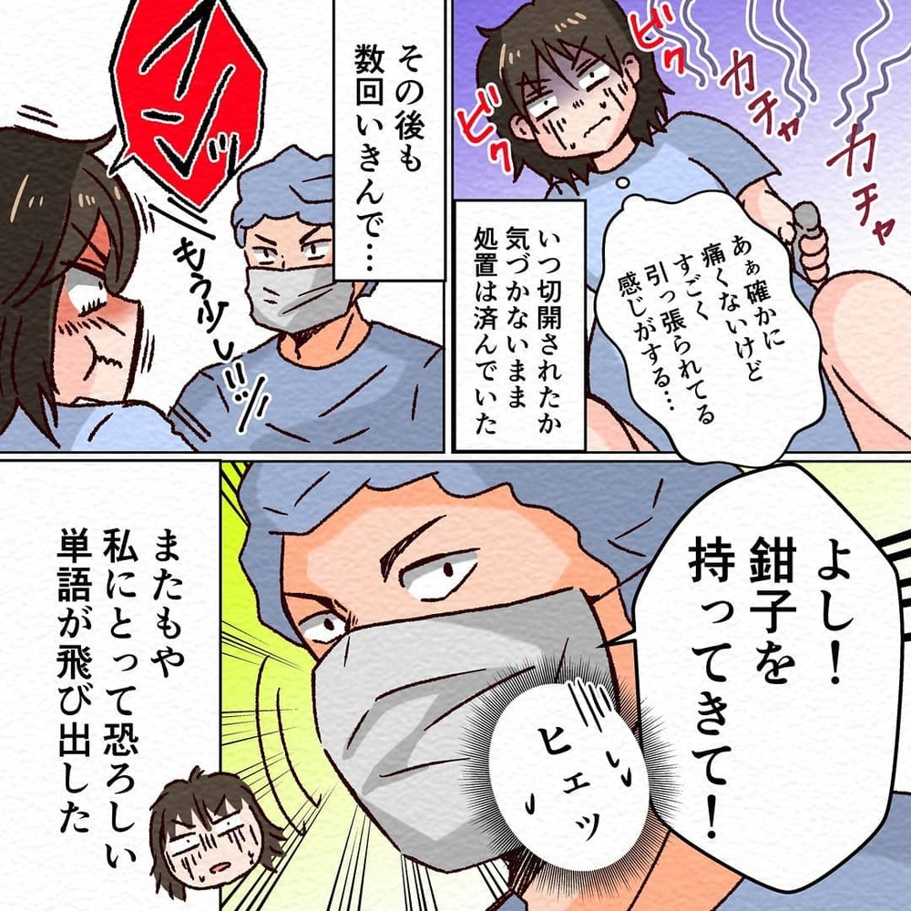 いきみの練習後ついに出産のとき！　痛みはなくても怖い…【無痛分娩で産みました  Vol.5】