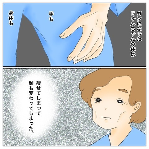 これがガンという病気なんだ… 久しぶりに会った叔母の姿にショック【鼻腔ガンになった話 Vol.63】