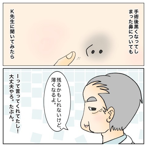 ガン闘病を振り返り…たくさんの人の助けがあって今がある【鼻腔ガンになった話 Vol.76】