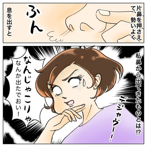 「できることはしてあげたい…！」 入院中我慢させてきた子どもたちのために【鼻腔ガンになった話 Vol.78】