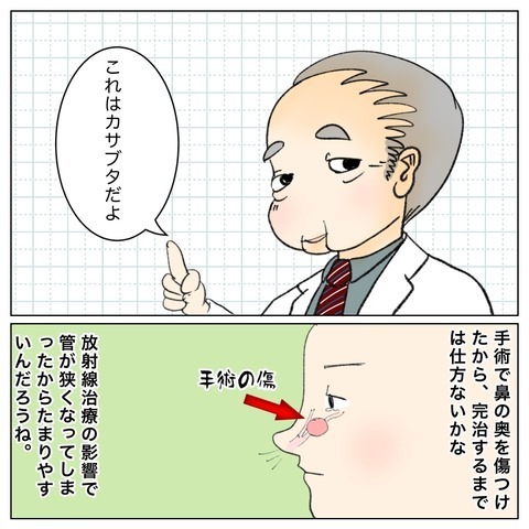 「病院に行くのが怖い」と感じたら… ガンという病気を経験して思うこと【鼻腔ガンになった話 Vol.79】