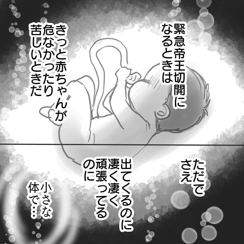 赤ちゃんが苦しんでいるかもしれない…そう思うと答えはひとつ！【緊急帝王切開出産レポ Vol.8】