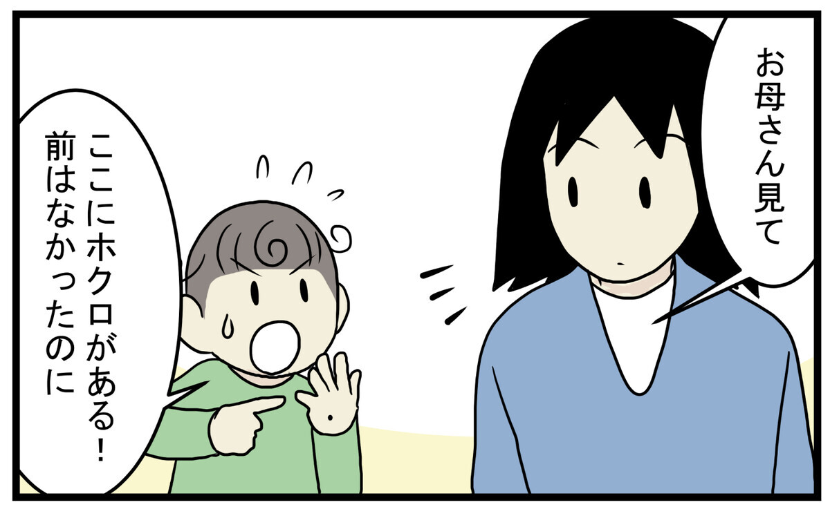 加齢により増える 息子が見つけてくれた私の 真っ赤なホクロ こどもと見つけた小さな発見日誌 Vol 43 ウーマンエキサイト 1 2