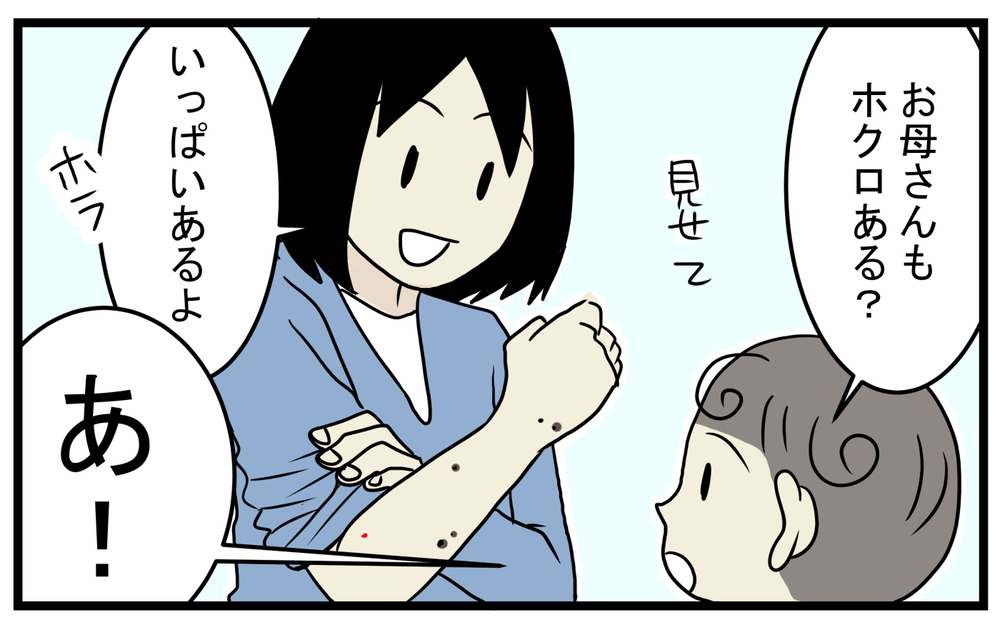 加齢により増える!? 息子が見つけてくれた私の「真っ赤なホクロ」【こどもと見つけた小さな発見日誌 Vol.43】