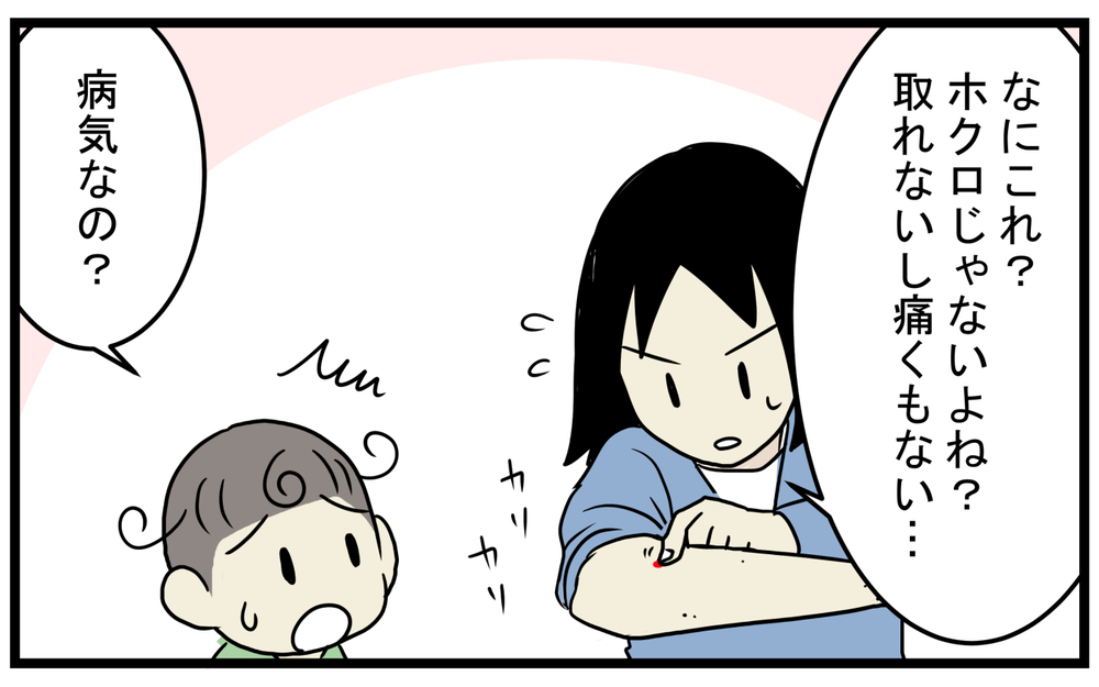 加齢により増える!? 息子が見つけてくれた私の「真っ赤なホクロ」【こどもと見つけた小さな発見日誌 Vol.43】