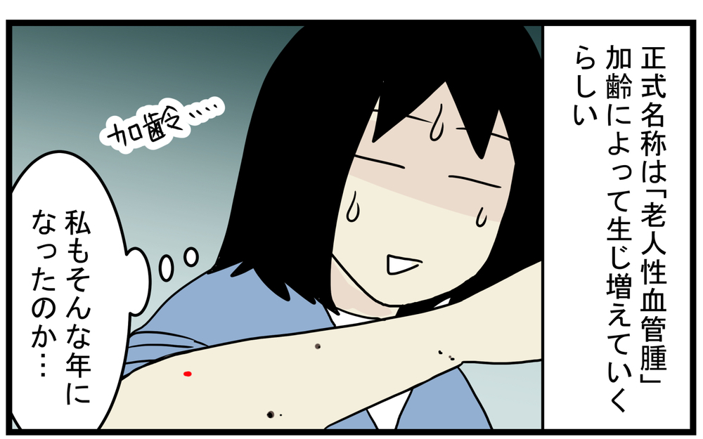 加齢により増える!? 息子が見つけてくれた私の「真っ赤なホクロ」【こどもと見つけた小さな発見日誌 Vol.43】