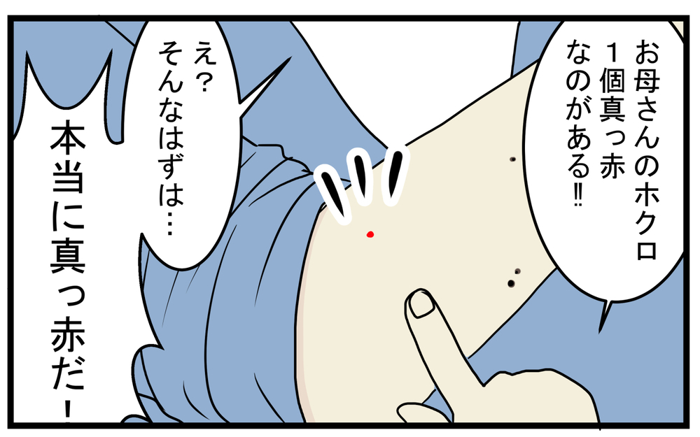 加齢により増える!? 息子が見つけてくれた私の「真っ赤なホクロ」【こどもと見つけた小さな発見日誌 Vol.43】