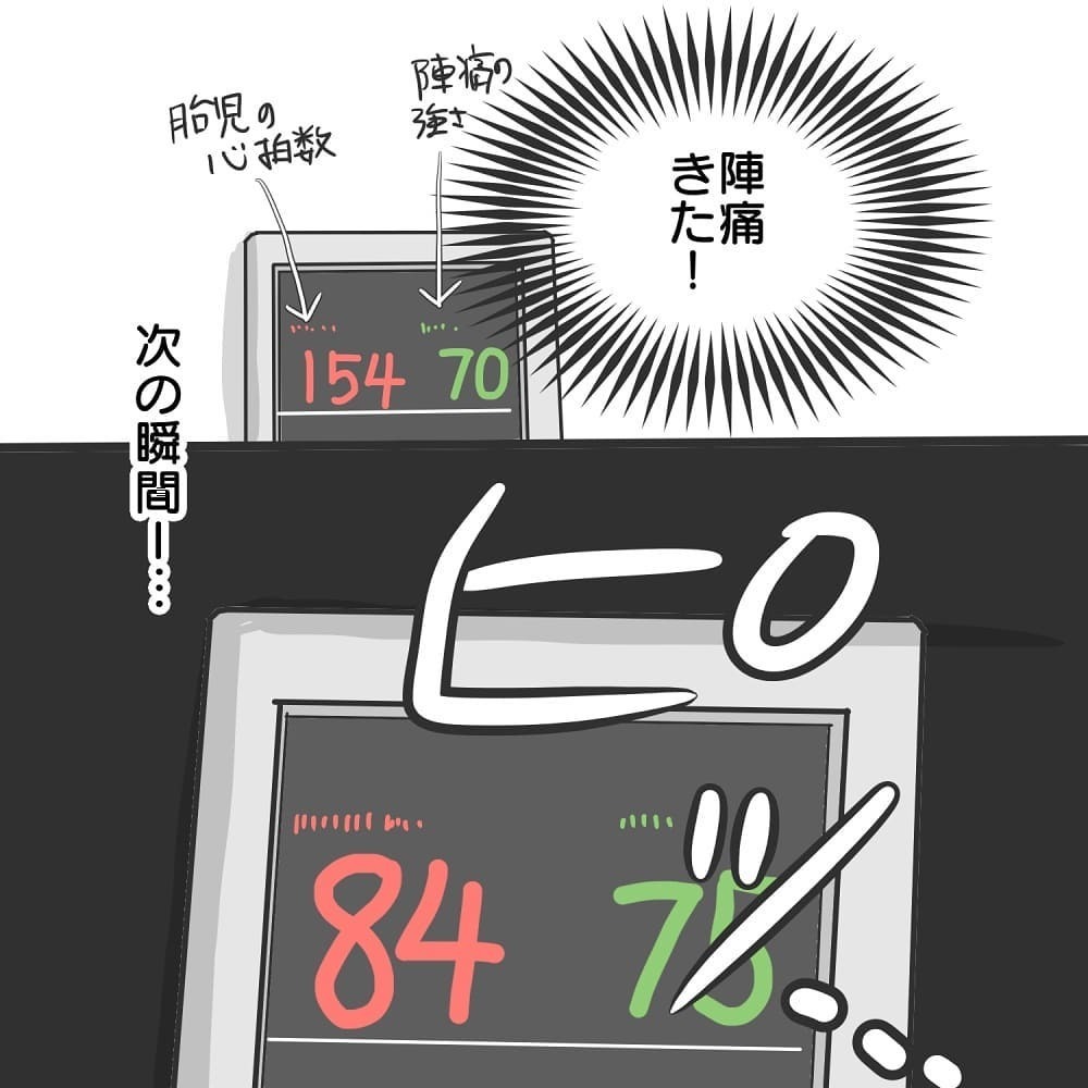 先生からまさかの無茶ぶり！ 陣痛MAX状態でアレを要請…!?【緊急帝王切開出産レポ Vol.11】