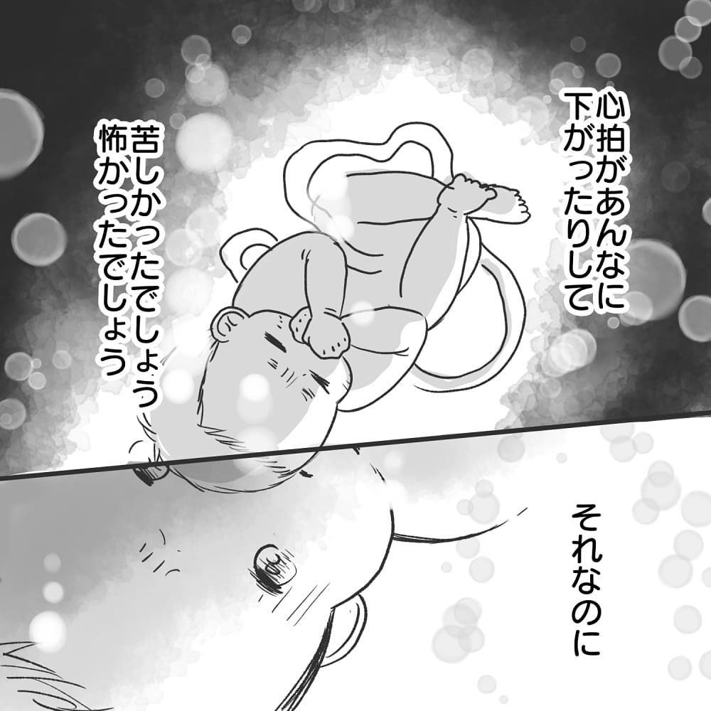 外に出ようとがんばってくれていた赤ちゃん　その様子を知り涙が溢れる【緊急帝王切開出産レポ Vol.14】