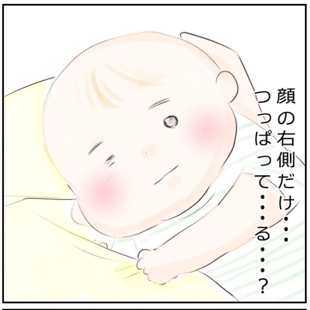 「顔の右側だけつっぱってる…？」退院から1ヶ月後に起きた異変【生後3ヶ月の息子が小児顔面麻痺に Vol.6】