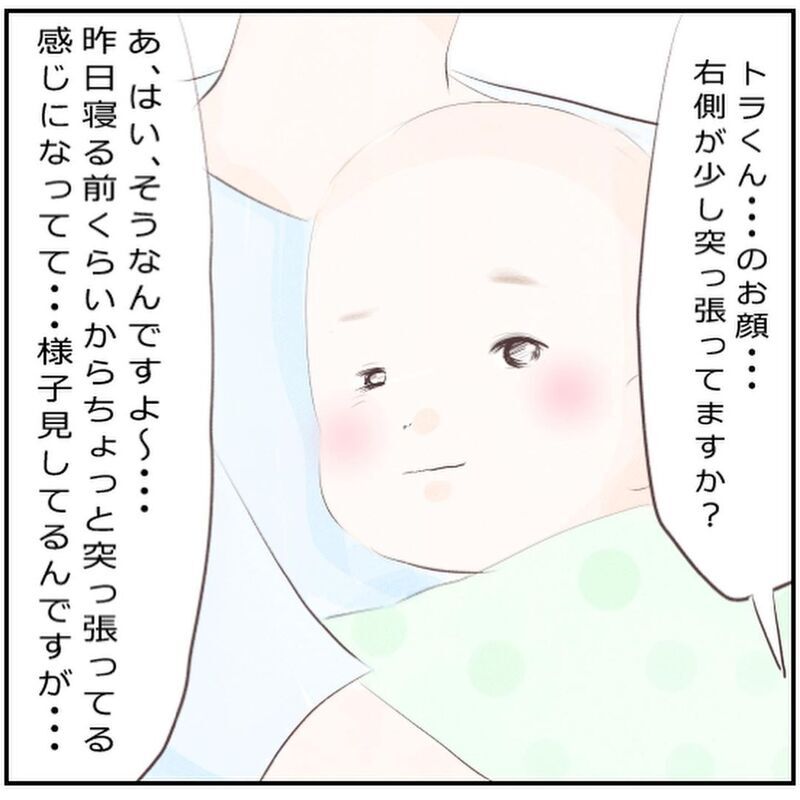 気になる息子の症状　保育園の先生にも心配され募る不安【生後3ヶ月の息子が小児顔面麻痺に Vol.7】